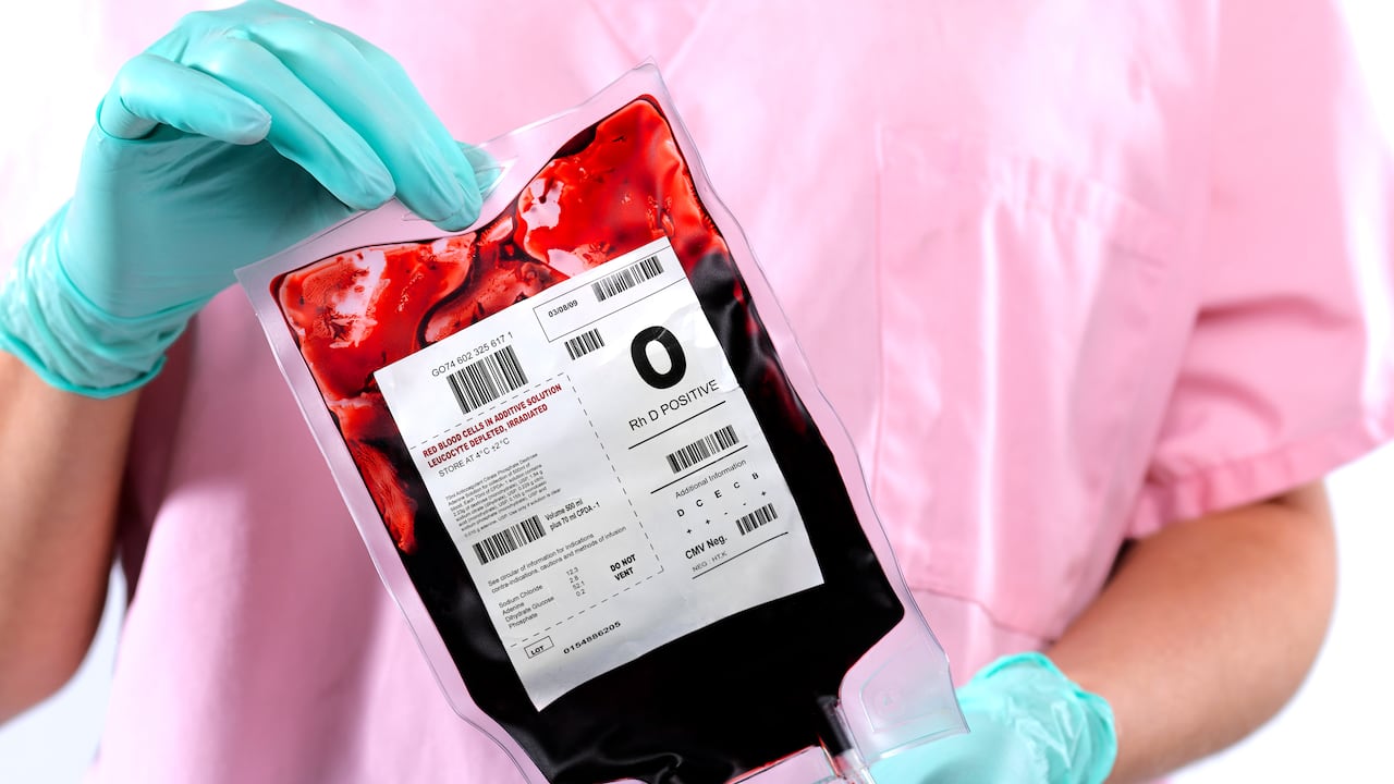 Existen afecciones relacionadas con las lágrimas de sangre.