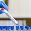 Omicron Variant on test tube - New Variant of Covid 19