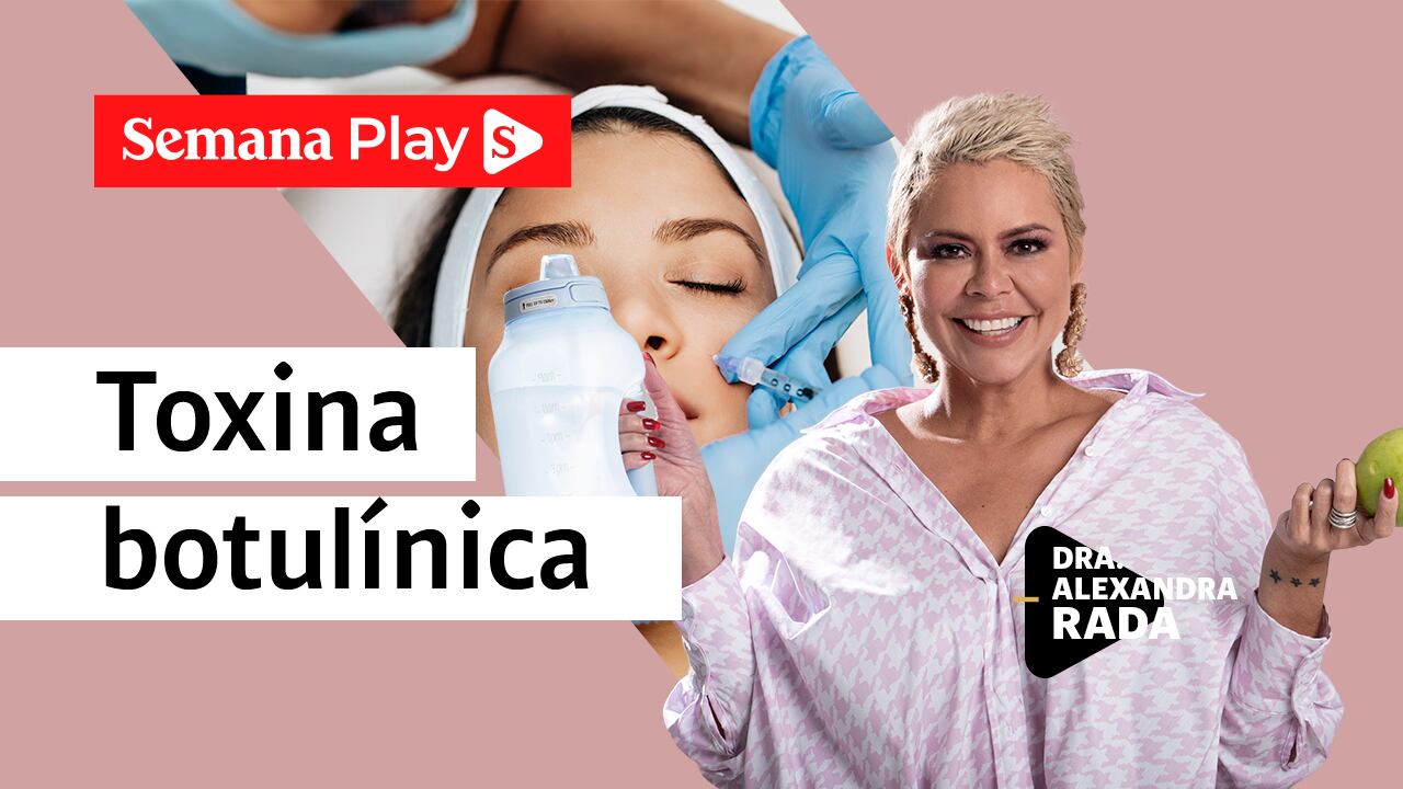 Toxina botulínica - Alexandra Rada- EstéticaMENTE