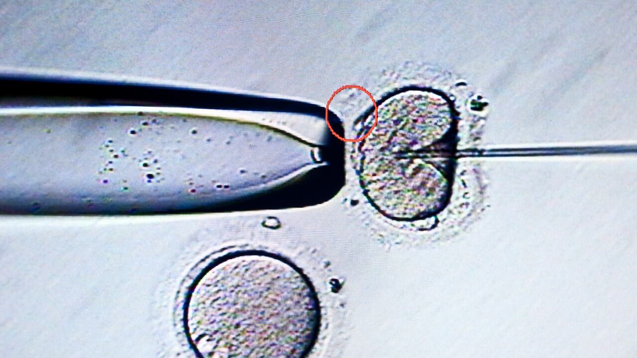 Imagen de referencia, no corresponde al caso en mención.