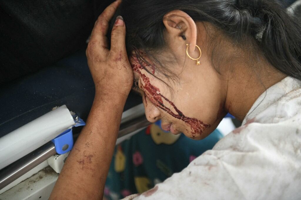 Se ve sangre en el rostro de una sobreviviente de un terremoto mientras descansa en un hospital en Naypyidaw el 28 de marzo de 2025, después de un terremoto en el centro de Myanmar. Un poderoso terremoto sacudió el centro de Myanmar el 28 de marzo, deformando carreteras en la capital Naypyidaw, dañando edificios y obligando a la gente a huir a las calles en la vecina Tailandia. (Foto de Sai Aung PRINCIPAL / AFP)