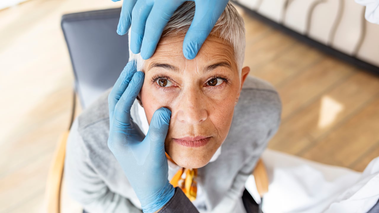 Cataratas - ojos - visión