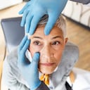 Cataratas - ojos - visión