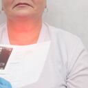 Hay varios síntomas a los que hay que estar alerta que pueden indicar el desarrollo del cáncer de cuello y cabeza.