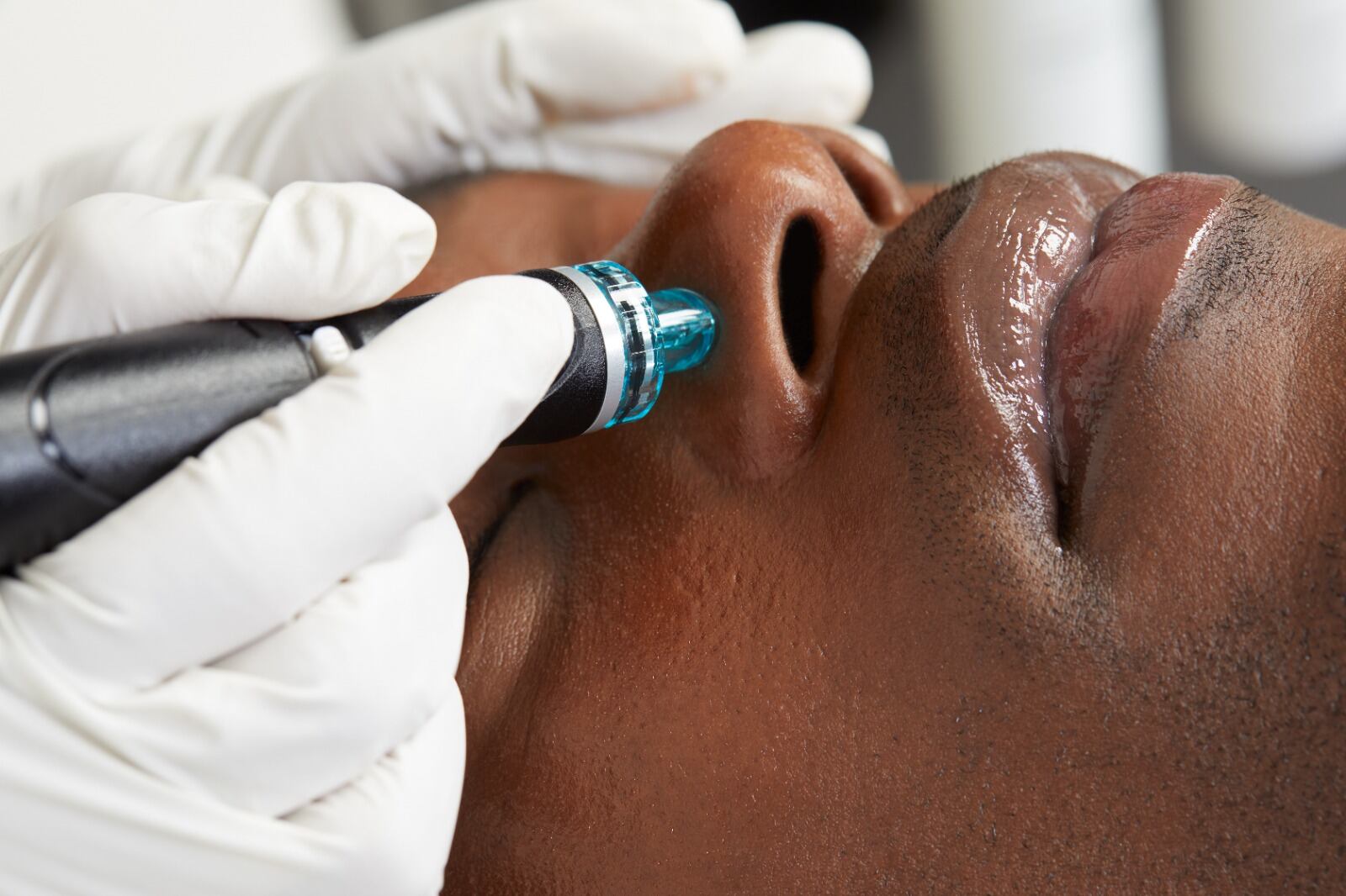 tratamiento para la piel