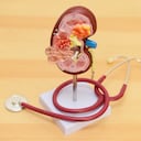 El cáncer de riñón no suele tener signos o síntomas en sus primeras etapas.