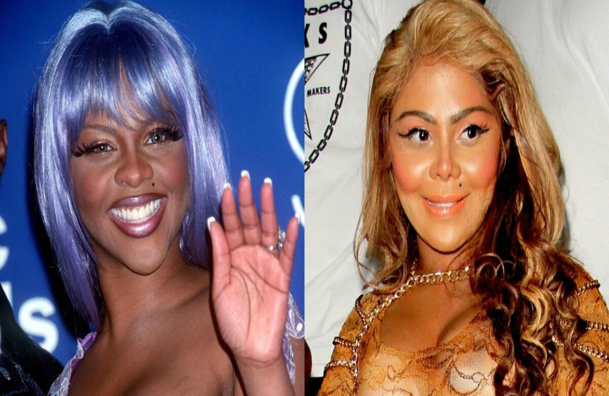 La cantante Lil’ Kim niega haberse hecho cirugías, pero los medios estadounidenses hablan de rinoplastia, bótox, rellenos faciales y aclaramiento de piel.