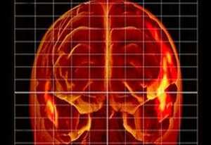 Para el estudio se usó una técnica de estimulación magnética transcraneana.