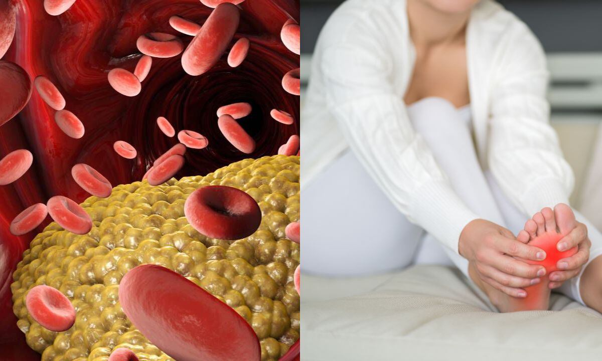 Los niveles altos de triglicéridos y ácido úrico son perjudiciales.