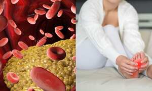 Los niveles altos de triglicéridos y ácido úrico son perjudiciales.