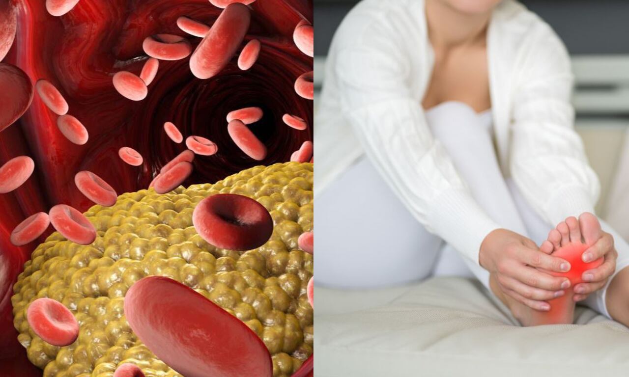 Los niveles altos de triglicéridos y ácido úrico son perjudiciales.