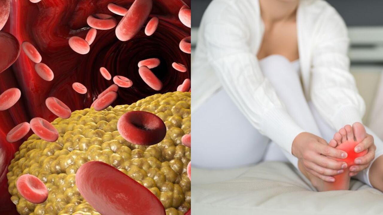 Los niveles altos de triglicéridos y ácido úrico son perjudiciales.