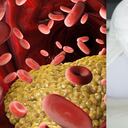 Los niveles altos de triglicéridos y ácido úrico son perjudiciales.