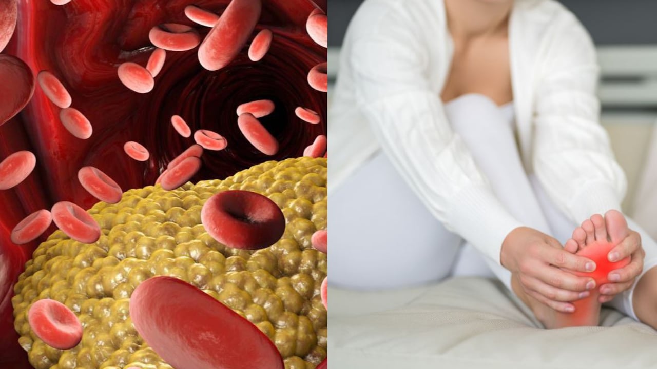 Los niveles altos de triglicéridos y ácido úrico son perjudiciales.