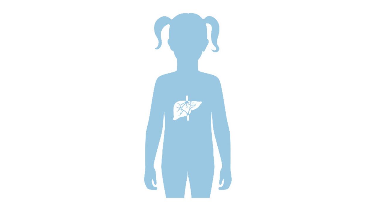 Foto de referencia sobre hepatitis infantil