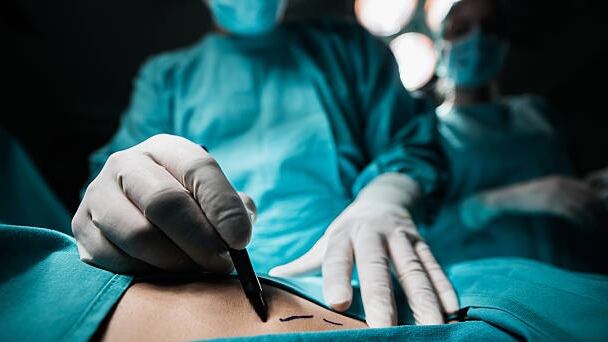 La víctima se realizó un procedimiento en el abdomen.