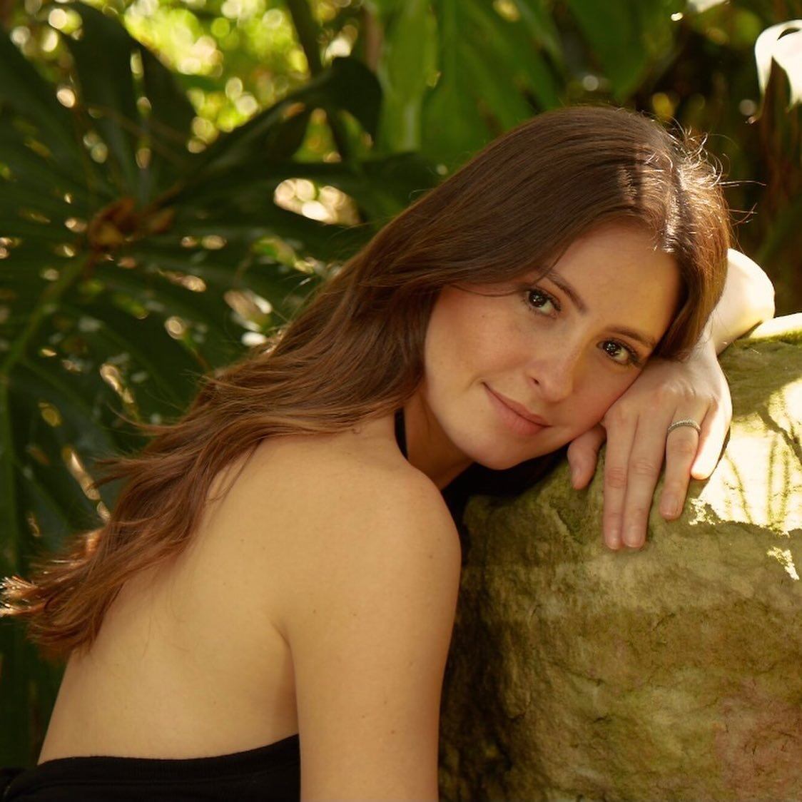 Taliana Vargas reveló que sufre de fuerte enfermedad en su piel