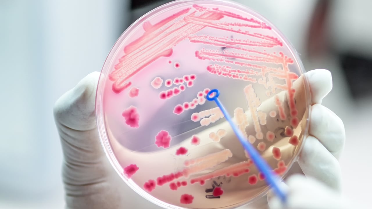 Los antibióticos eficaces son la base de la medicina moderna y son necesarios para procedimientos rutinarios como la cirugía o la terapia inmunosupresora.