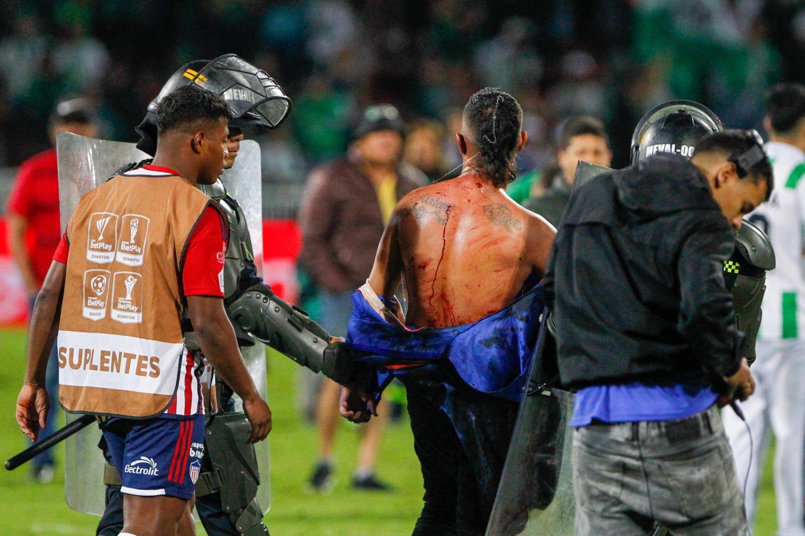 En videos que circulan por medio de las redes sociales se pueden ver a algunos hinchas heridos.