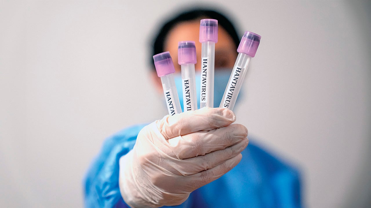 Muestras médicas son analizadas en laboratorio en medio de las investigaciones relacionadas con el hantavirus.