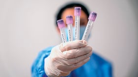 Hantavirus - Foto de referencia