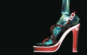 Pocos creen que los tacones altos pueden incidir en el biomecanismo de la marcha y causar daños a los músculos de las piernas (Fotos: Thinkstock)