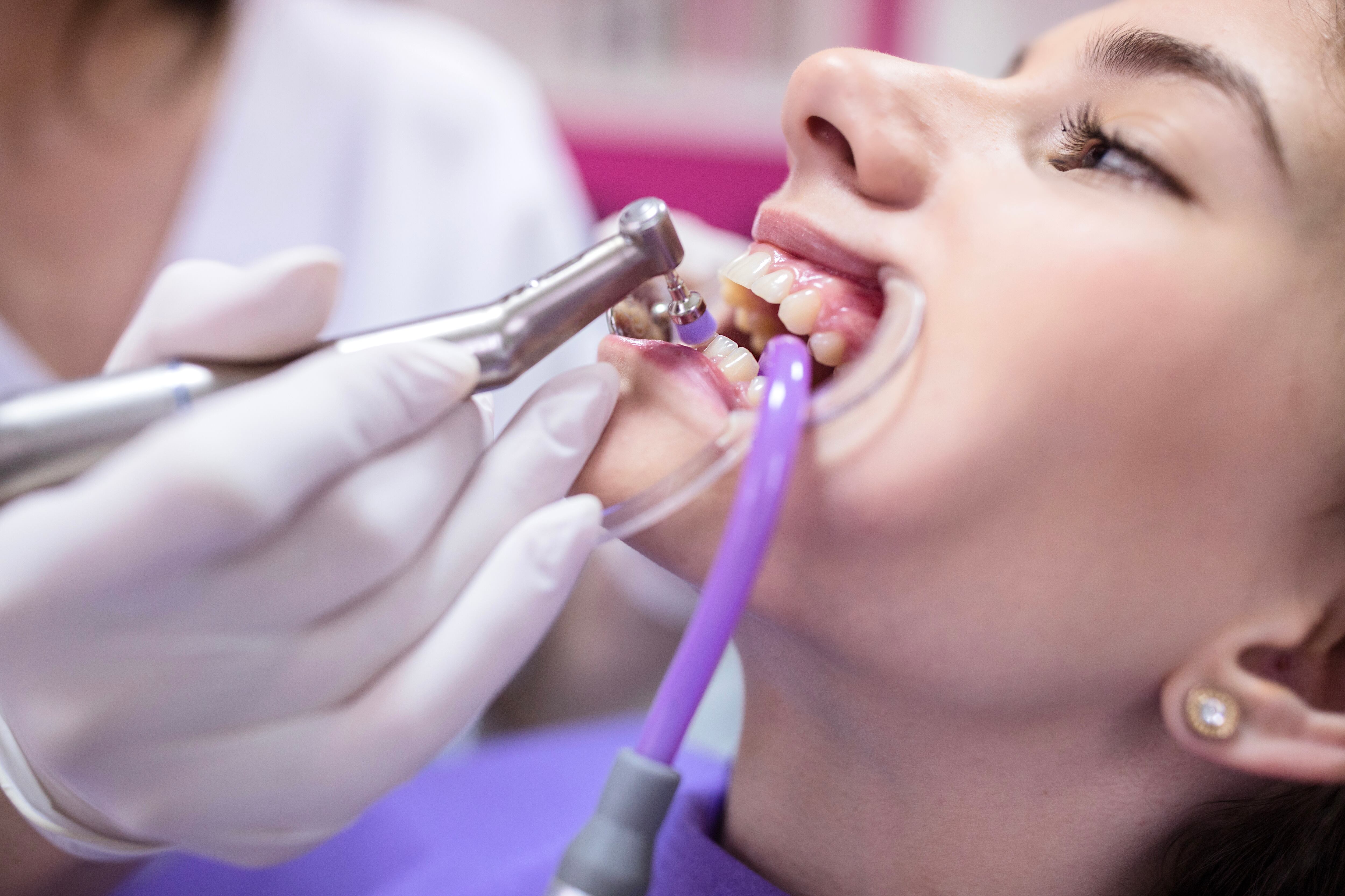 Es importante cepillar frecuentemente los dientes.