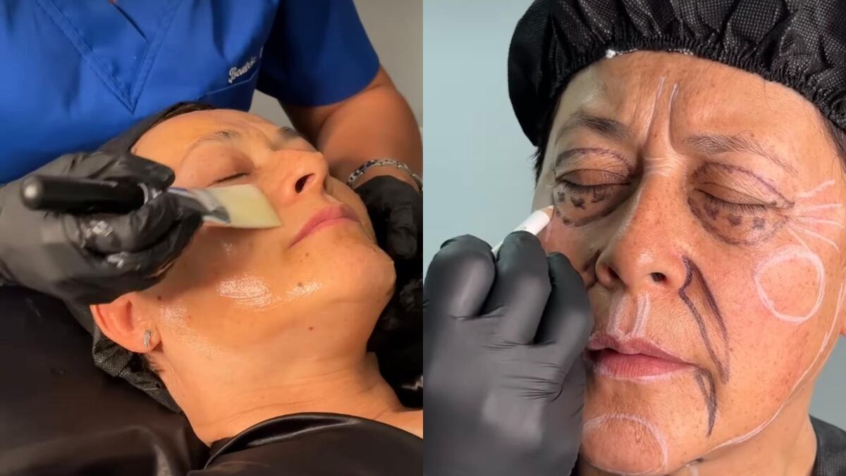 Los 'retoques' de Alina Lozano estuvieron enfocados en rejuvenecer su apariencia.