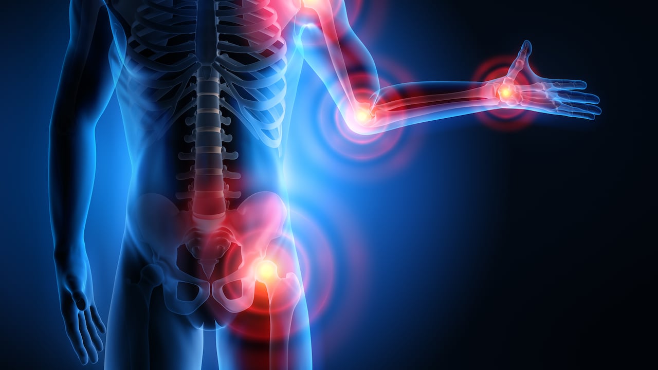 Huesos / Sistema óseo / Dolor huesos