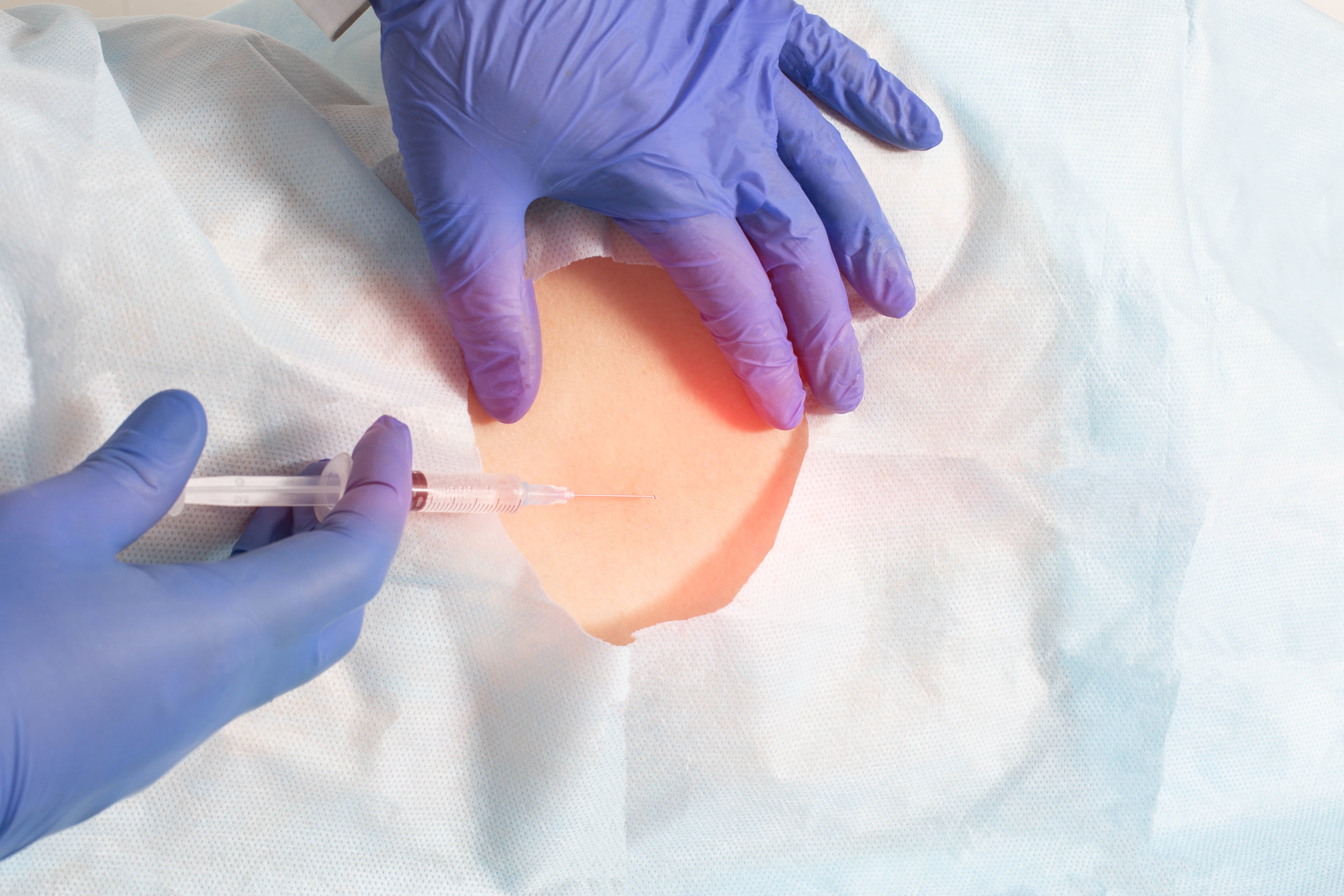 Infiltraciones de columna