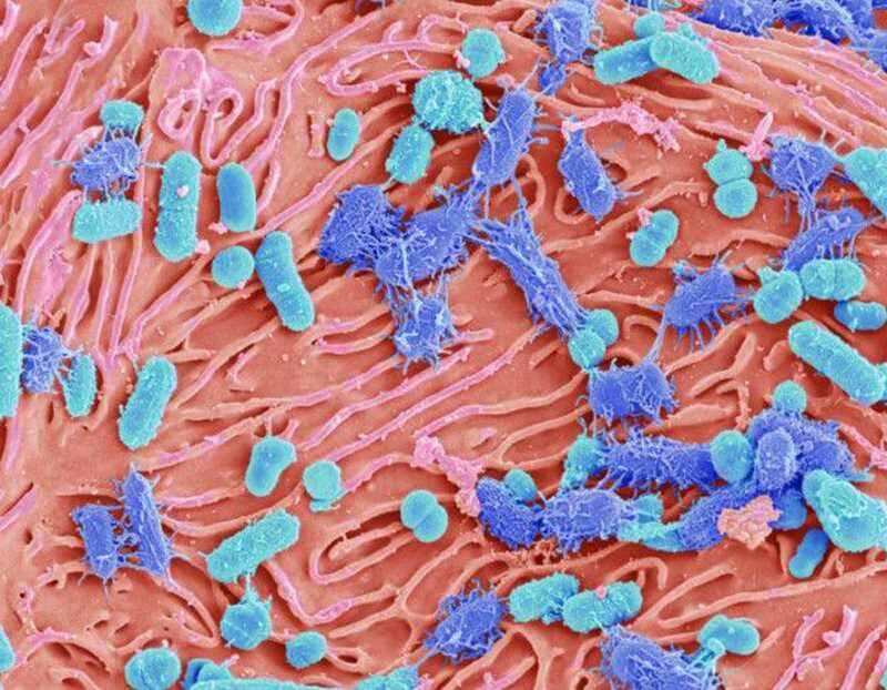 Aproximadamente hay 200 tipos de bacterias responsables de las caries. 