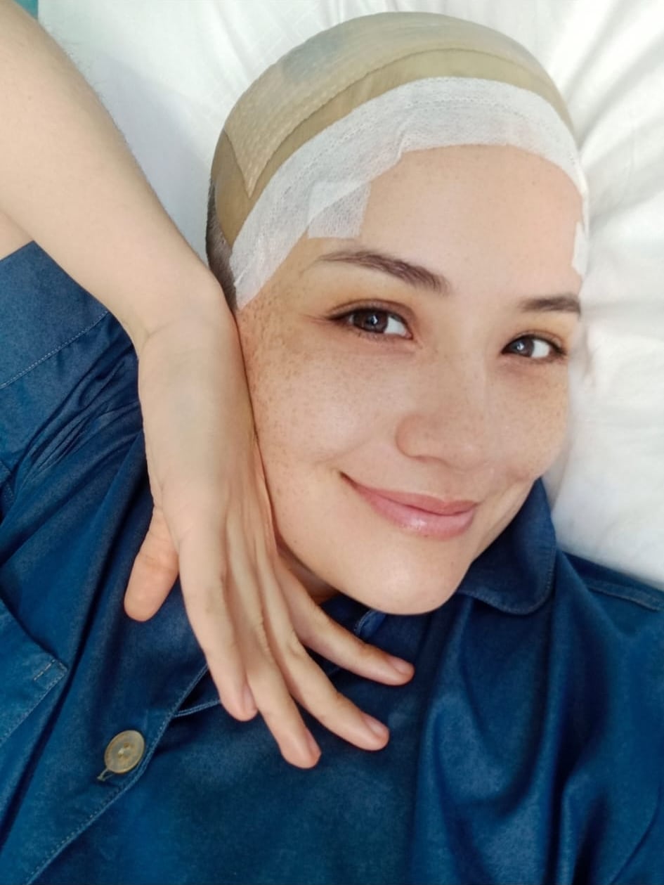 SEMANA conversó con Lorena Rodríguez sobre su operación de estimulación cerebral profunda para tratar su trastorno mixto ansioso-depresivo.