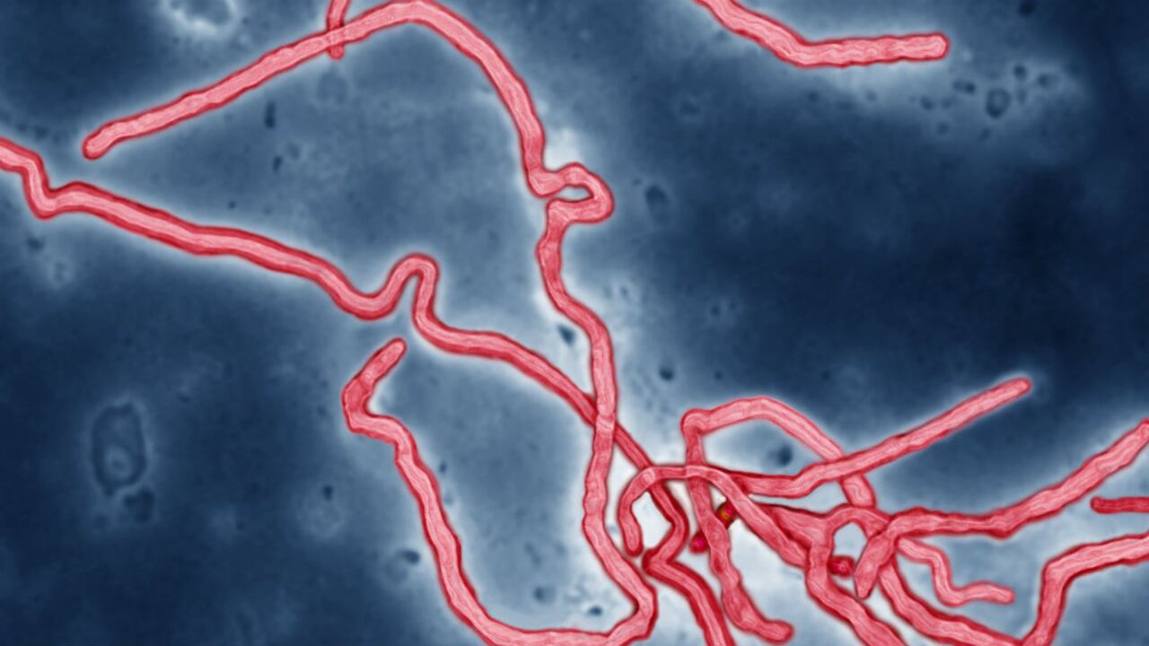 Virus del ébola.