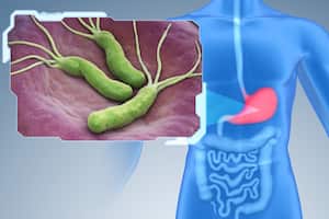 Helicobacter Pylori is a Gram-negative, microaerophilic bacterium found in the stomach. 3D illustration