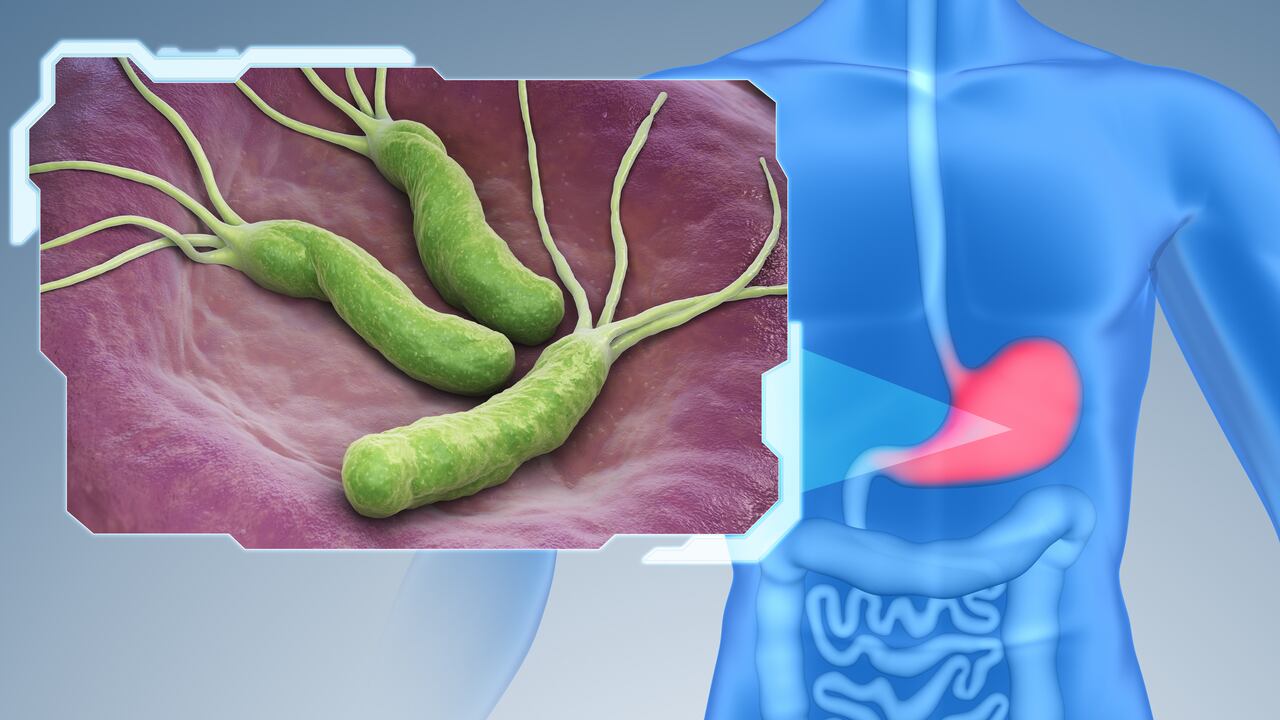 Helicobacter Pylori es una bacteria de forma espiral crece en la capa mucosa que recubre el interior del estómago.