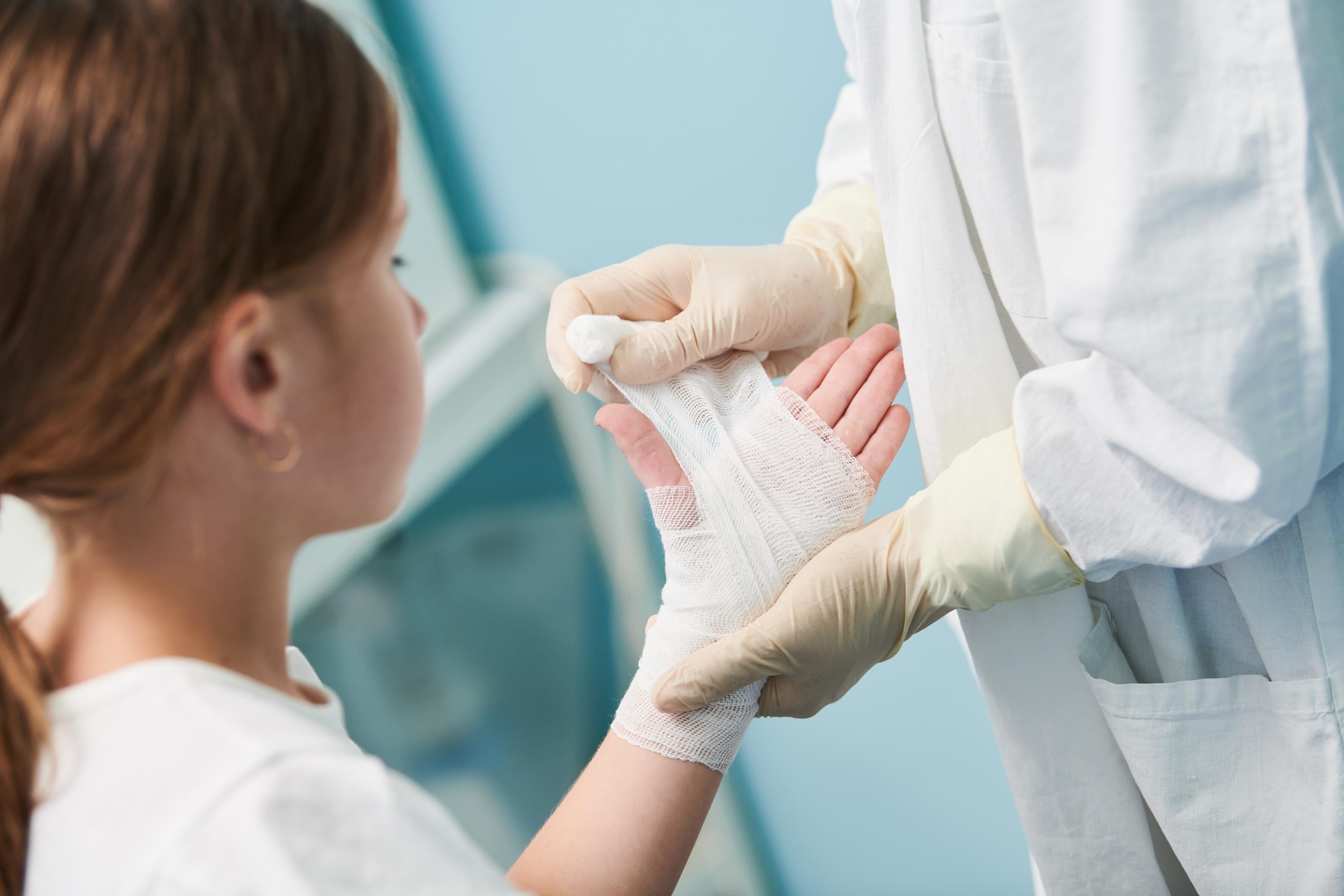 Las quemaduras en casa tienen un incremento en la época de diciembre, se recomienda no usar remedios caseros para tratarlas, debe consultarse inmediatamente al médico.