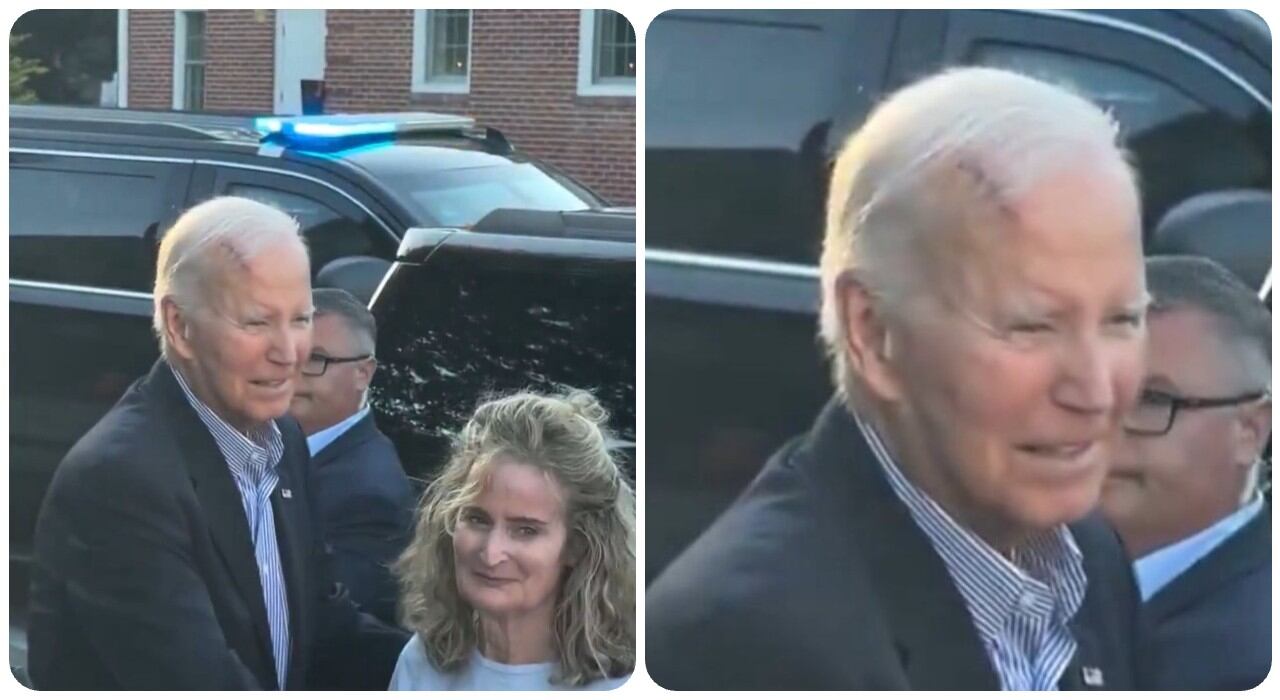 La cicatriz de Biden genera preocupaciones