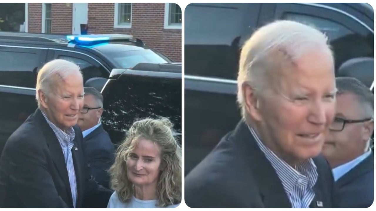 La cicatriz de Biden genera preocupaciones