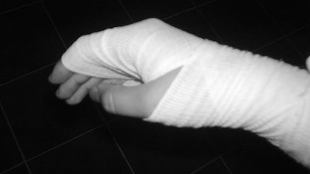 Menor falleció tras resultar quemado por accidente con una botella de gasolina en Codazzi, Cesar