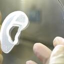 El implante fue obtenido de células del paciente afectado.