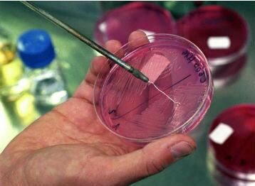 Sobre la tuberculosis, la evidencia científica encontró asociación específica para los eventos de salud y peor pronóstico de covid-19  para los pacientes con esta enfermedad, que es una patología infectocontagiosa causada por una bacteria denominada Mycobacterium tuberculosis o bacilo de Koch