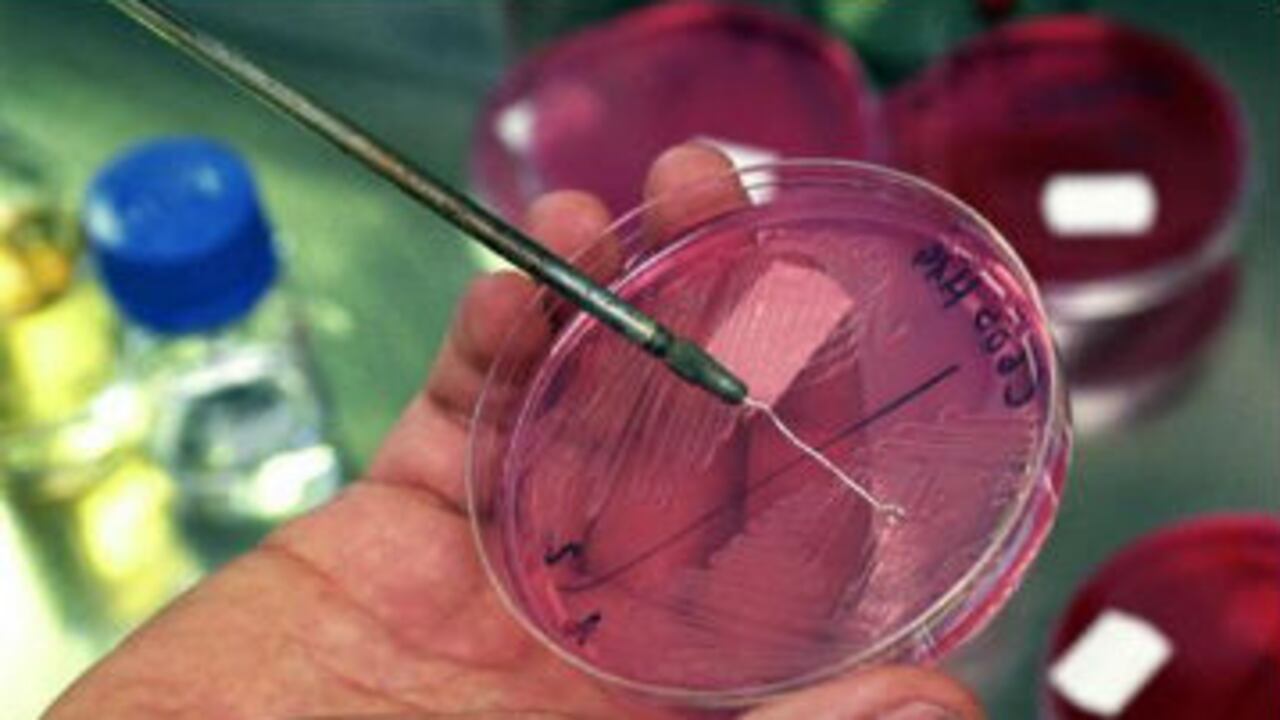 La tuberculosis está considerada como una enfermedad silenciosa pero mortal.