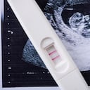 Cerca de píldoras y prueba de embarazo en imagen de ultrasonido