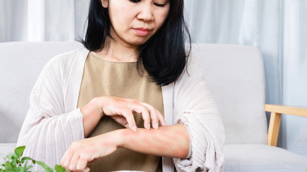 ¿Es posible eliminar las alergias alimentarias sin medicamentos?