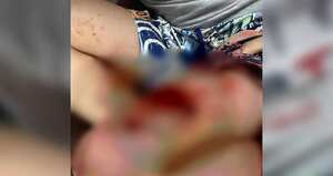 Los tres menores de edad se recuperan de las graves lesiones que les ocasionó el perro.