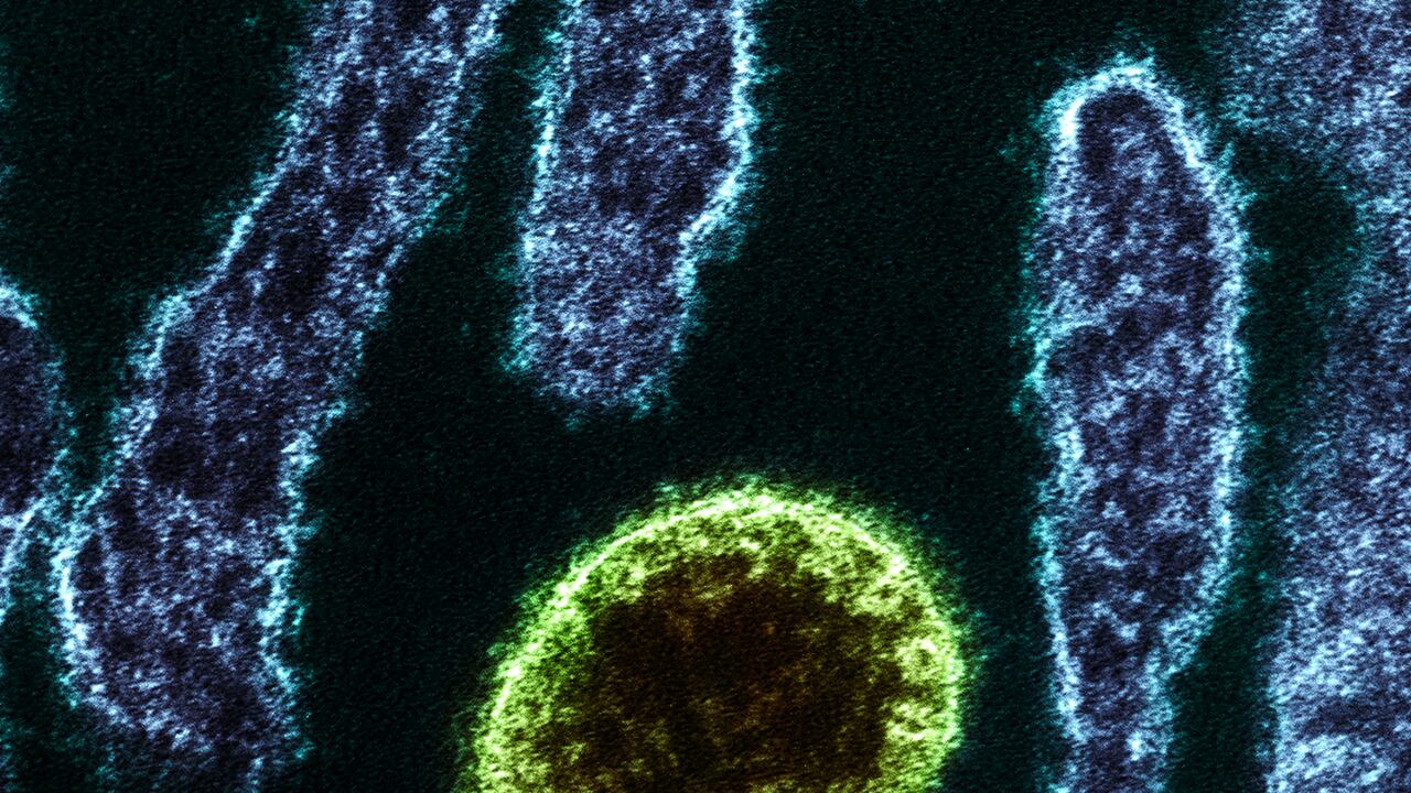 Colorized transmission electron micrograph of a mature extracellular Nipah Virus particle (green) near the periphery of an infected VERO cell (blue). Image captured and color-enhanced at the NIAID Integrated Research Facility in Fort Detrick, Maryland. Credit: NIAID. (Photo by: IMAGE POINT FR/NIH/NIAID/BSIP/Universal Images Group via Getty Images)