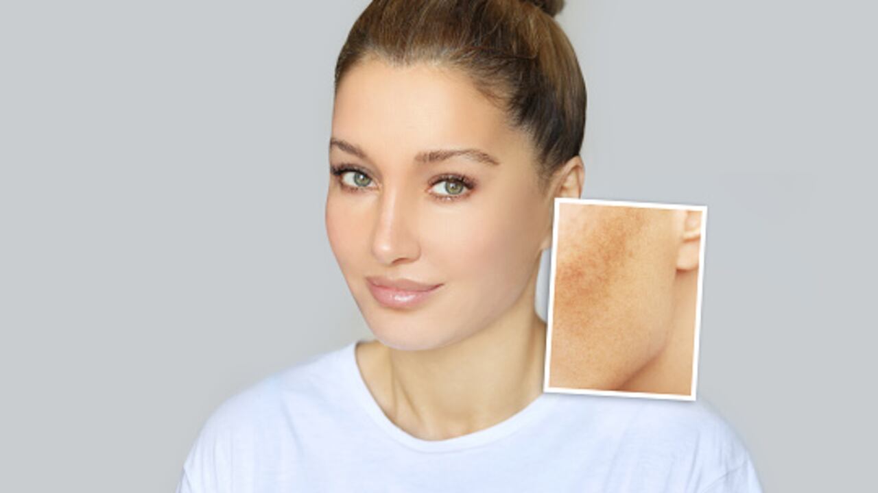 Las razones por las que aparecen las manchas en el rostro.