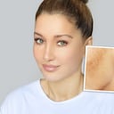 Las razones por las que aparecen las manchas en el rostro.