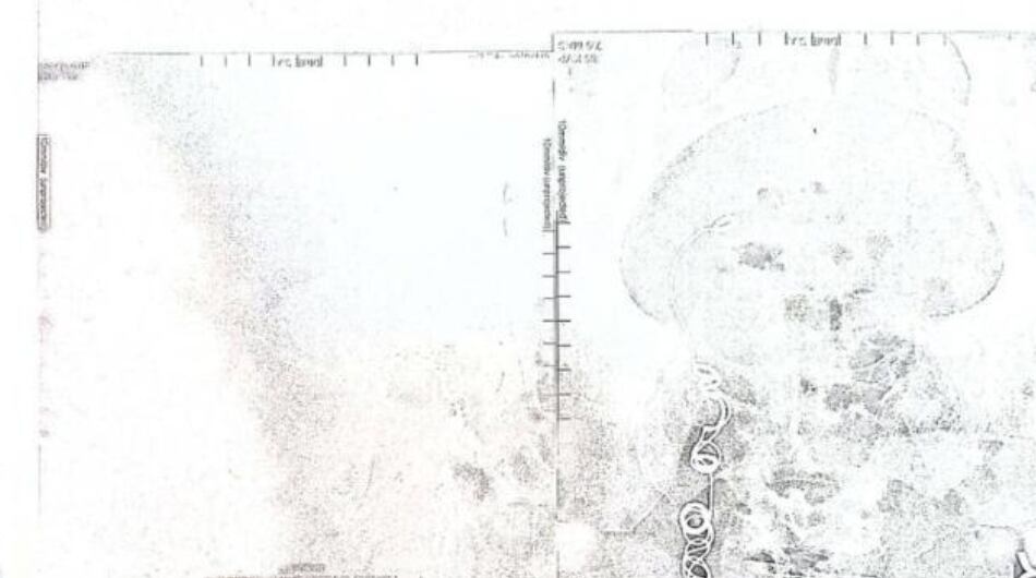 Examen médico de María Aderlinda Forero Vargas.