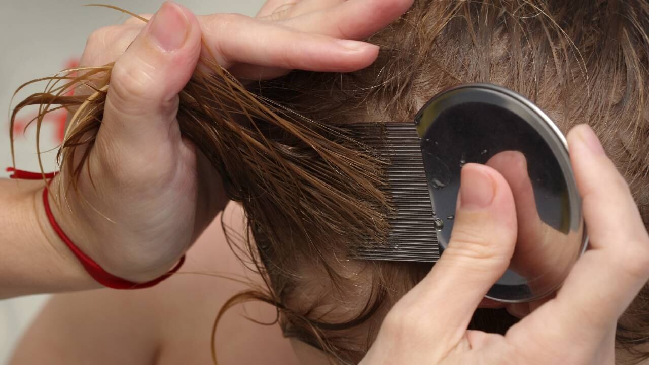 Juntar la cabeza con personas infestadas es la forma más común de transmisión de piojos.